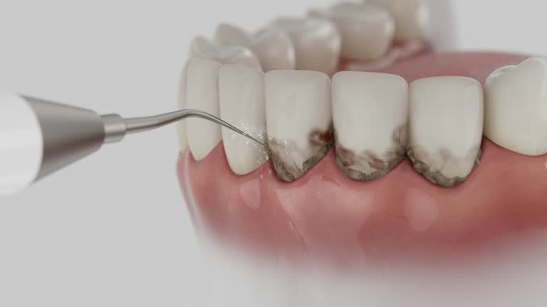 Reliable Emergency Dentist contractor in Bountiful, UT by Smile Center Dentistry